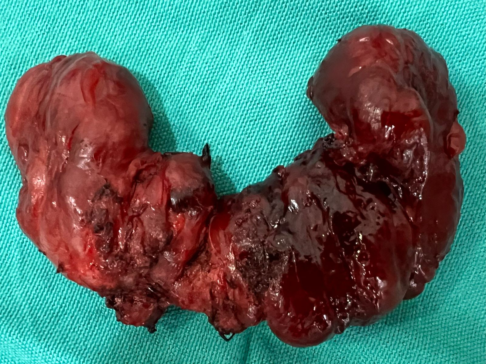 إنجاز طبي يثبت قوة تداوي في التعامل مع أصعب الحالات